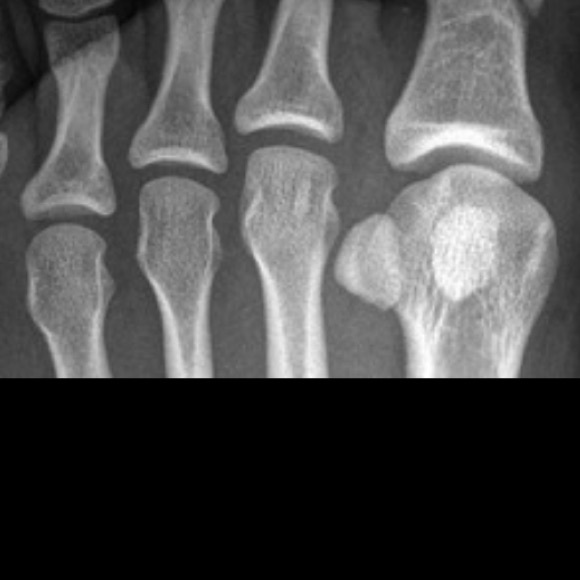 My surgery was a success. Thank you for everything - Picture 4 of 4